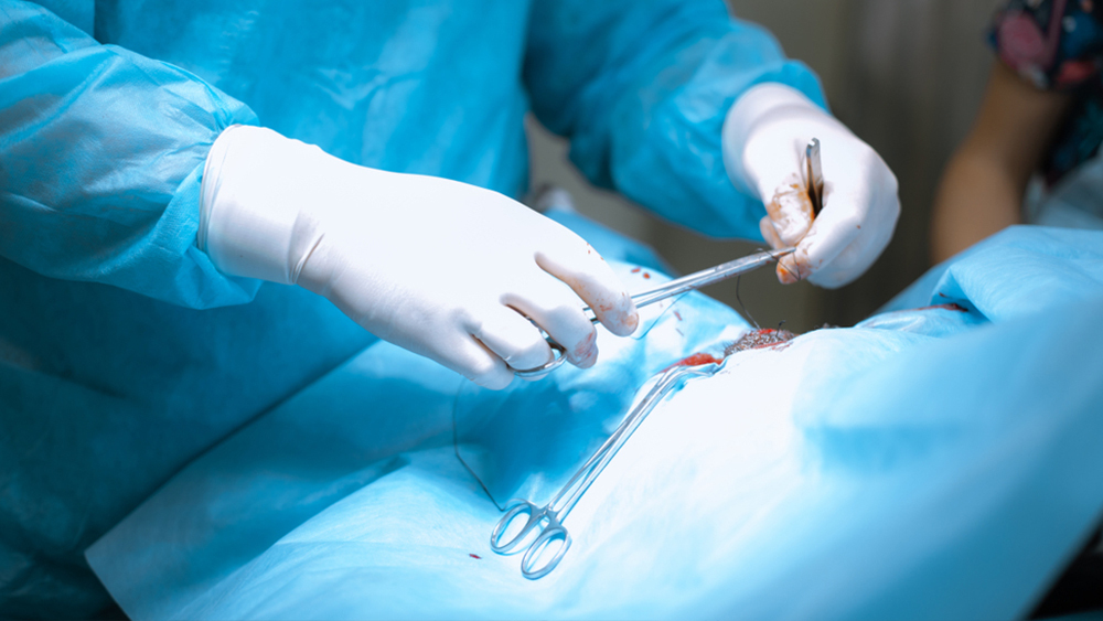 Open Surgical Procedures – Dr. B. Premkumar